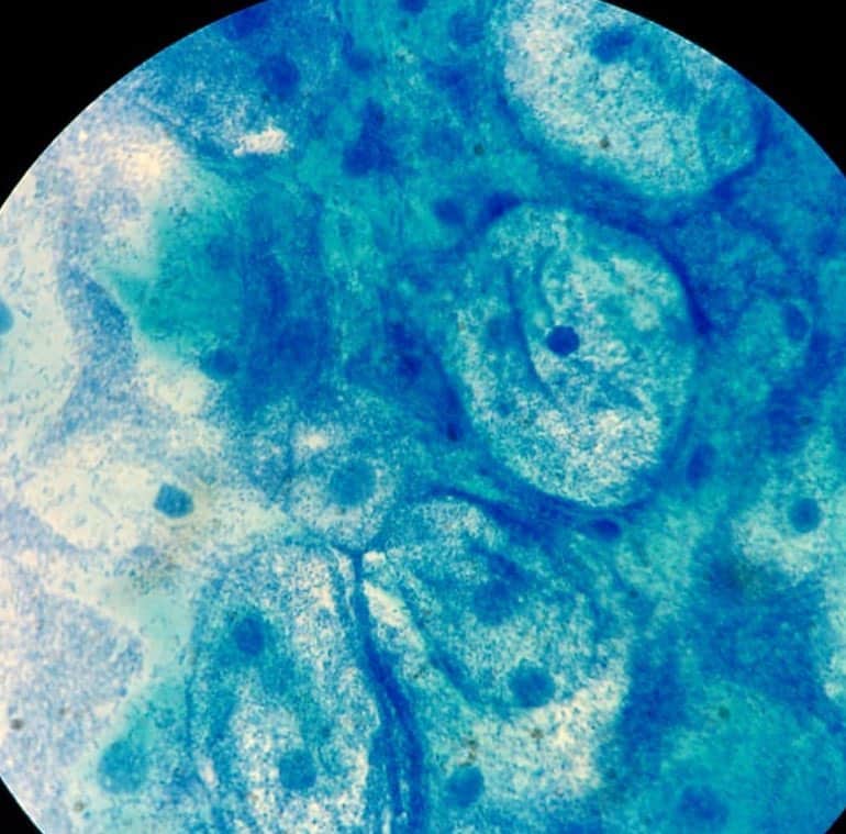 microbes enlarged image