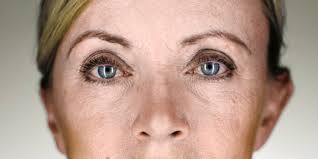 facial wrinkles