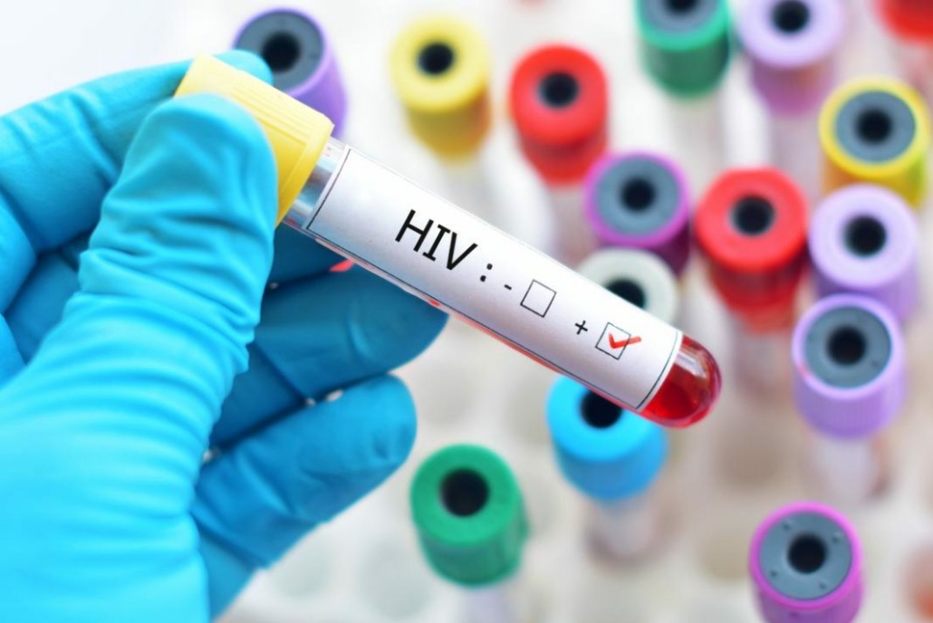 lečenje HIV
